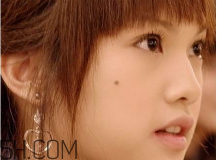 痣是怎么形成的？女人痣長哪里最有福氣