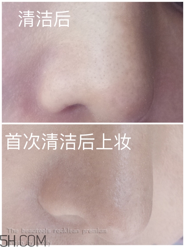 the beautools毛孔清潔器好用嗎_24k黑頭鏟評(píng)測