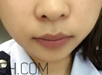 小蜜蜂細(xì)致修護(hù)唇膏很油嗎？夏天用合適嗎？