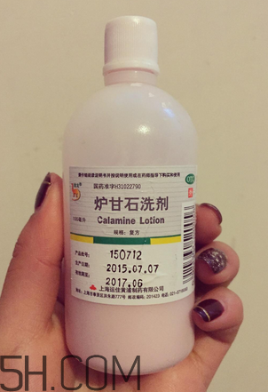 爐甘石洗劑多少錢一瓶？爐甘石洗劑治痤瘡嗎？