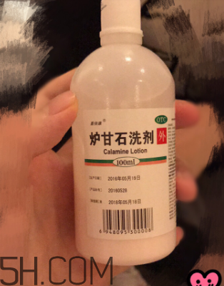 爐甘石洗劑是洗還是擦？爐甘石洗劑是什么顏色？