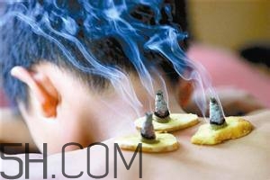 艾灸對慢性咽炎有用嗎？慢性咽炎可以通過艾灸來治療嗎？