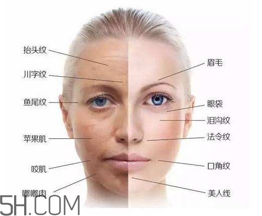 怎么預(yù)防皺紋的產(chǎn)生？導(dǎo)致皺紋的產(chǎn)生的原因有哪些？