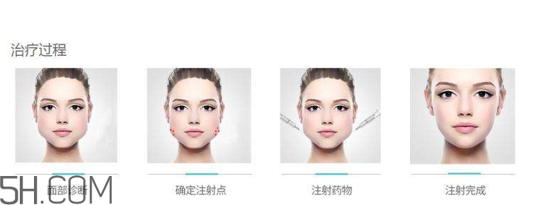 打瘦臉針可以抽煙嗎？打瘦臉針會(huì)反彈嗎？