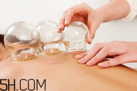 拔罐可以治療鼻炎嗎？鼻炎拔罐拔哪里？