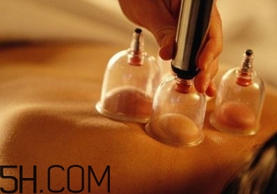 拔罐可以治療鼻炎嗎？鼻炎拔罐拔哪里？