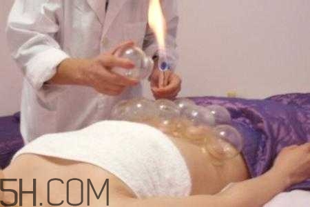腹部拔罐可以減肥嗎？腹部拔罐拔哪個位置？