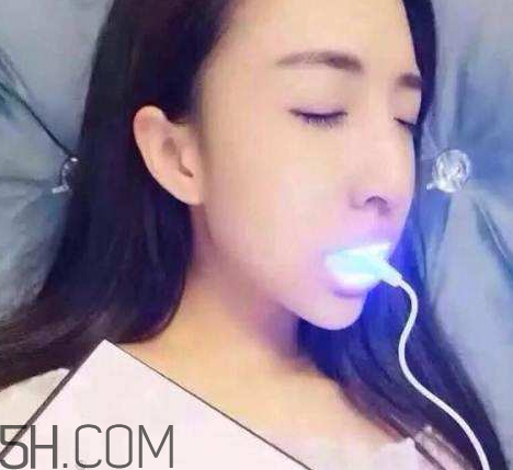 美牙儀可以兩個(gè)人用嗎？美牙儀用多久才有作用？