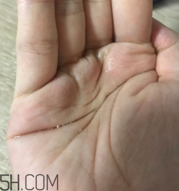 雪肌精卸妝油糊眼睛嗎？雪肌精卸妝油悶痘嗎？