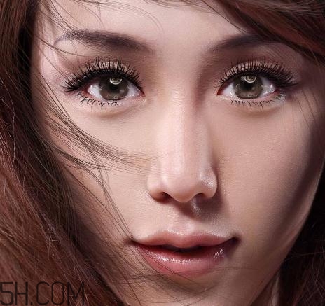 上瞼提肌手術(shù)有必要嗎？上瞼提肌后是永久的嗎？