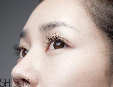 上瞼提肌手術(shù)有必要嗎？上瞼提肌后是永久的嗎？