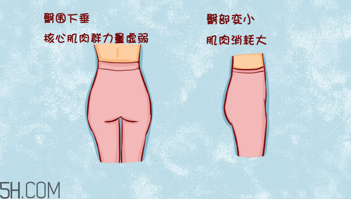 臀部護理對健康有什么影響？日常如何保養(yǎng)臀部健康？