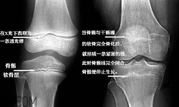 孩子學(xué)街舞好不好？學(xué)街舞好處多多