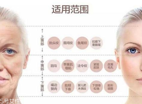 大v線會(huì)斷嗎？一定要選擇正規(guī)整形醫(yī)院
