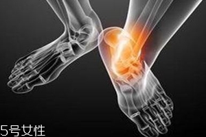 痛風(fēng)跟飲食有關(guān)？痛風(fēng)更多與遺傳有關(guān)
