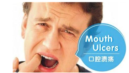 潰瘍的根源在哪里？也許僅僅只是牙膏沒選對(duì)