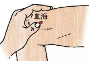 濕疹怎么治才管用？?jī)?nèi)外同治是關(guān)鍵