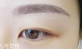 激光洗眉恢復(fù)期有疤痕怎么辦？激光洗眉毛之后正確護(hù)理方法