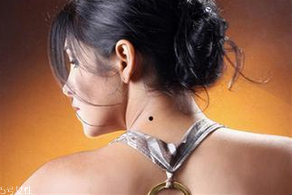 脖子后面有痣代表什么？10大身體缺陷是好事