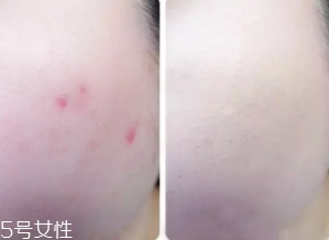 cpb遮瑕棒怎么樣？來看看使用效果