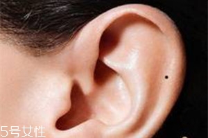 臉上哪些痣不能去掉？這些痣不能隨便祛掉