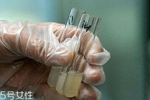 捐精有什么危害？專家稱沒有危害