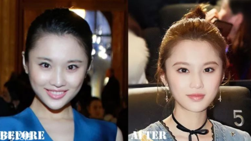 瑯琊榜2張慧雯整容了嗎？換了妝發(fā)美到不認(rèn)識(shí)