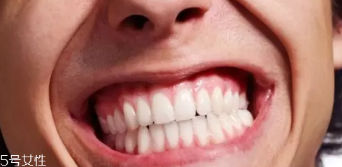 磨牙是因為受了委屈？孩子的心理狀況也會導致磨牙