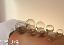 拔火罐引火上身的原因是什么？這4點(diǎn)要注意