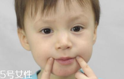 冬天爛嘴角什么原因？有可能營養(yǎng)不良
