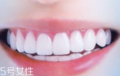 牙線和漱口水是否必要？抑菌護(hù)牙好習(xí)慣