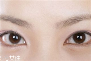 割雙眼皮后怎樣恢復(fù)快？女人不能割雙眼皮的時期