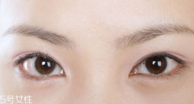 割雙眼皮的術(shù)前準(zhǔn)備有哪些？割雙眼皮的常見做法
