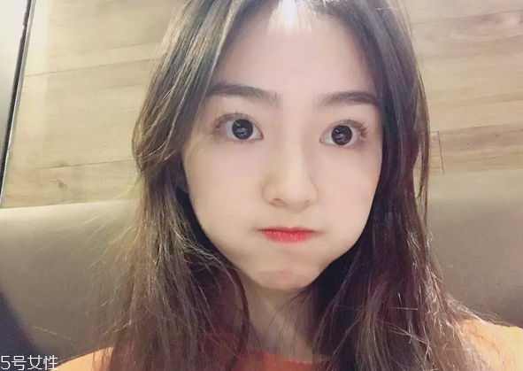 割雙眼皮要注意什么？割雙眼皮充血是正?，F(xiàn)象