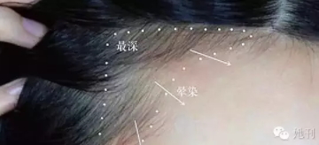 眉粉可以當(dāng)發(fā)際線粉嗎？解救高發(fā)際線的技巧