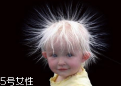 少年白什么原因？焦慮緊張會(huì)得病