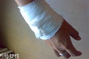 被蜈蚣咬傷后能治愈嗎？科學家有新發(fā)現(xiàn)