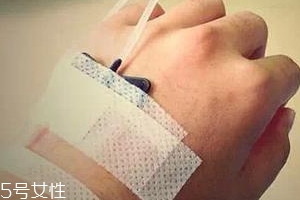 輸液管進空氣會死人嗎？危險但很難發(fā)生
