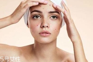 痘痘反復(fù)長是什么原因？基礎(chǔ)護膚不夠用心
