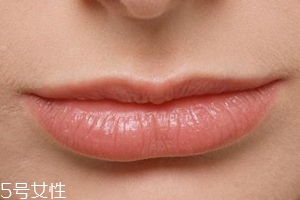 嘴唇干裂是一種病嗎？治療口角炎從改善習慣入手
