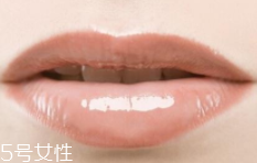 嘴唇干裂是一種病嗎？治療口角炎從改善習(xí)慣入手
