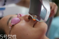 科技脫毛有哪些種類？冰點(diǎn)脫毛不毀毛囊