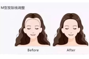 發(fā)際線粉填充和發(fā)際線筆哪個(gè)好？配合使用才最完美