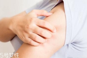 身體皮膚干燥用什么護(hù)膚品？這些身體乳拯救爆皮掉屑
