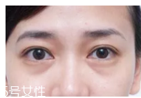黑眼圈用什么眼霜好？多效護(hù)理型眼霜是首選