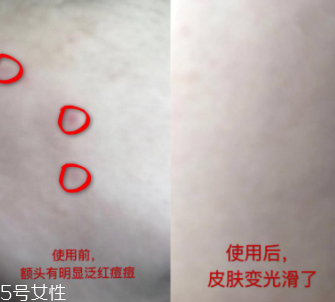 資生堂紅腰子適合什么年齡？最適合30歲以下人群