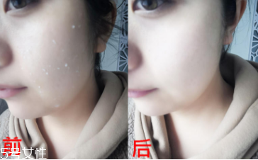 rosette去角質(zhì)凝膠怎么樣？真正的去角質(zhì)產(chǎn)品
