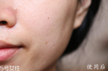 悅木之源和伊麗莎白雅頓哪個好？兩款精華大比拼