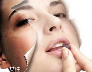 春季如何預(yù)防皮膚過敏？選擇敏感肌專用護膚品