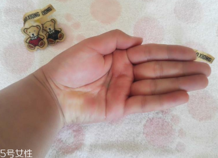 柳屋生發(fā)水有用嗎？一個(gè)月后長(zhǎng)出新發(fā)